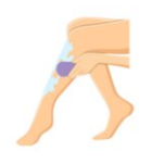 Hair Removal